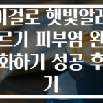 이걸로 햇빛알레르기 피부염 완화하기 성공 후기