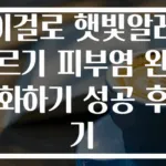 이걸로 햇빛알레르기 피부염 완화하기 성공 후기
