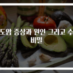 담도암 증상과 원인 그리고 수술 비밀