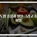 담도암 증상과 원인 그리고 수술 비밀