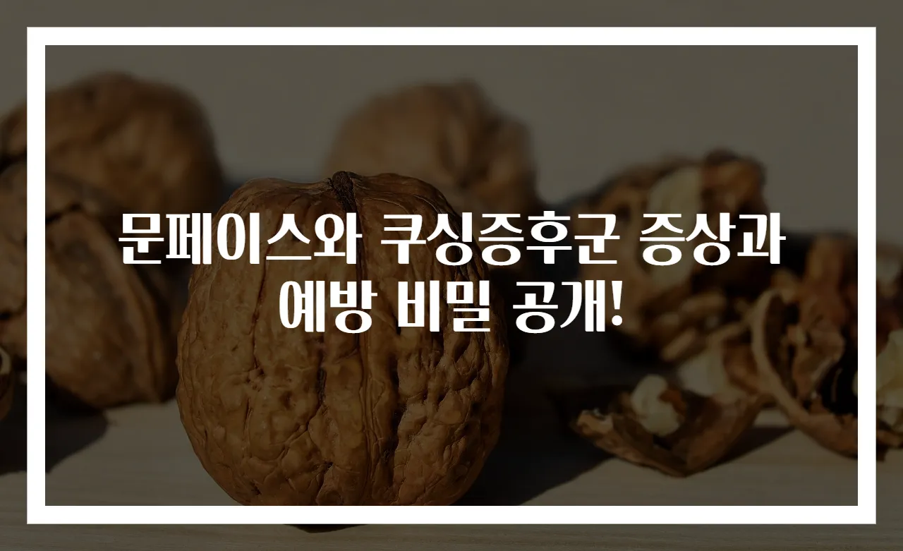 문페이스와 쿠싱증후군 증상과 예방 비밀 공개!