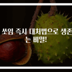 벌 쏘임 즉시 대처법으로 생존하는 비밀!