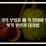 손가락 부었을 때 꼭 알아야 할 붓기 원인과 대처법
