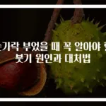 손가락 부었을 때 꼭 알아야 할 붓기 원인과 대처법