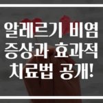 알레르기 비염 증상과 효과적 치료법 공개!