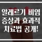 알레르기 비염 증상과 효과적 치료법 공개!