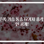 오른쪽 가슴 통증 12가지 충격 원인 공개!