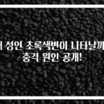 왜 성인 초록색변이 나타날까? 충격 원인 공개!