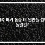 왼쪽 머리 통증 이 원인들 깜짝 놀랄걸?