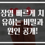장염 빠르게 치유하는 비밀과 원인 공개!