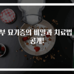 피부 묘기증의 비밀과 치료법 대공개!