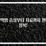 각막염 증상부터 치료까지 완전 정복!