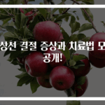 갑상선 결절 증상과 치료법 모두 공개!