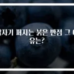 갑자기 퍼지는 붉은 반점 그 이유는?