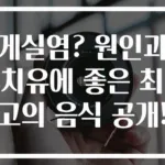 게실염? 원인과 치유에 좋은 최고의 음식 공개!