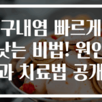 구내염 빠르게 낫는 비법! 원인과 치료법 공개