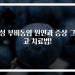 급성 부비동염 원인과 증상 그리고 치료법!