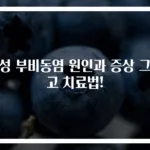 급성 부비동염 원인과 증상 그리고 치료법!