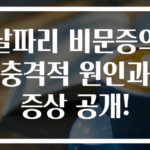 날파리 비문증의 충격적 원인과 증상 공개!