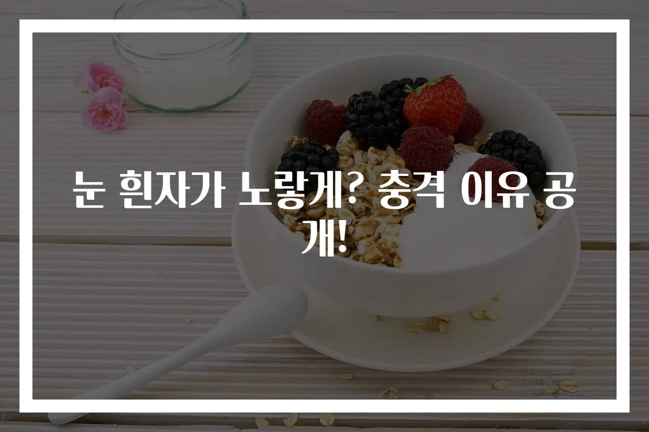 눈 흰자가 노랗게? 충격 이유 공개!
