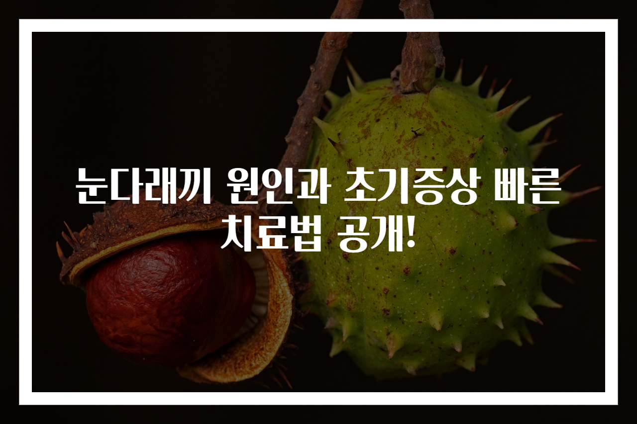 눈다래끼 원인과 초기증상 빠른 치료법 공개!