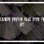 눈다래끼 원인과 치료 전염 걱정 끝!