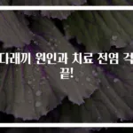 눈다래끼 원인과 치료 전염 걱정 끝!