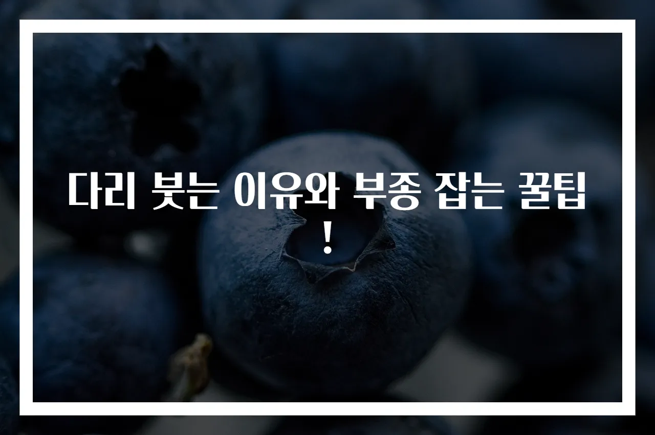 다리 붓는 이유와 부종 잡는 꿀팁!