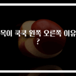 뒷목이 쿡쿡 왼쪽 오른쪽 이유는?