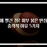 몸에 빨간 점? 피부 붉은 반점의 충격적 이유 5가지