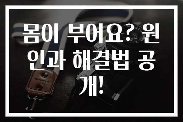 몸이 부어요? 원인과 해결법 공개!