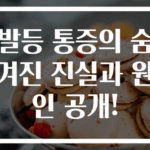 발등 통증의 숨겨진 진실과 원인 공개!