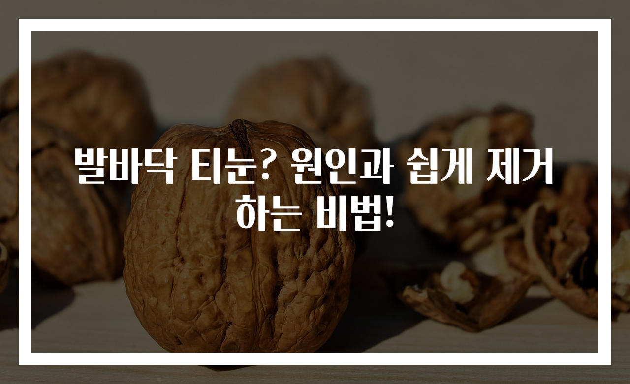 발바닥 티눈? 원인과 쉽게 제거하는 비법!
