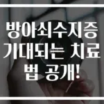 방아쇠수지증 기대되는 치료법 공개!