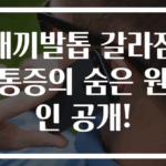 새끼발톱 갈라짐 통증의 숨은 원인 공개!