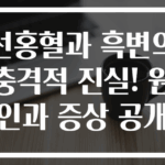 선홍혈과 흑변의 충격적 진실! 원인과 증상 공개