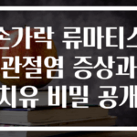손가락 류마티스 관절염 증상과 치유 비밀 공개