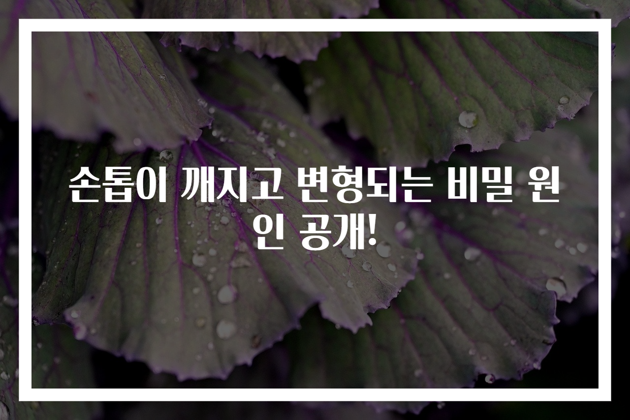 손톱이 깨지고 변형되는 비밀 원인 공개!