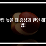 안압 높을 때 증상과 원인 해결법!