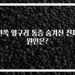 왼쪽 옆구리 통증 숨겨진 진짜 원인은?