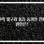 왼쪽 옆구리 통증 숨겨진 진짜 원인은?