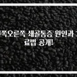 왼쪽오른쪽 쇄골통증 원인과 치료법 공개!