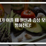 위가 아플 때 원인과 증상 모두 밝혀진다!