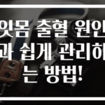 잇몸 출혈 원인과 쉽게 관리하는 방법!