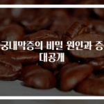 자궁내막증의 비밀 원인과 증상 대공개