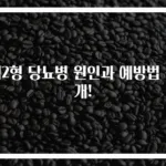 제2형 당뇨병 원인과 예방법 공개!
