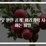 탈모 원인 공개! 머리카락 사수하는 비밀