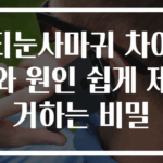 티눈사마귀 차이와 원인 쉽게 제거하는 비밀