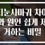 티눈사마귀 차이와 원인 쉽게 제거하는 비밀