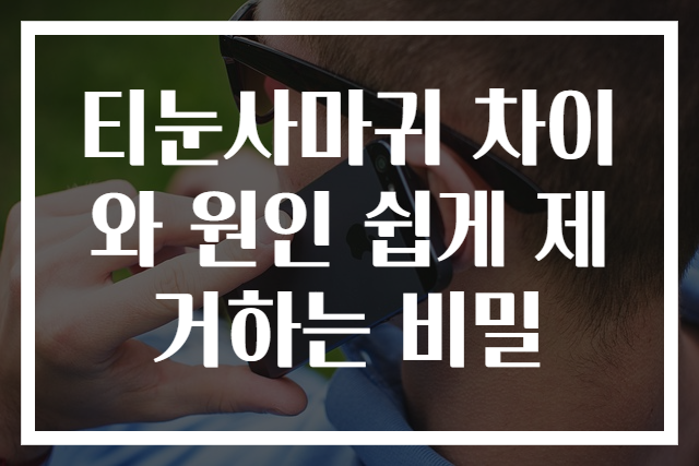 티눈사마귀 차이와 원인 쉽게 제거하는 비밀